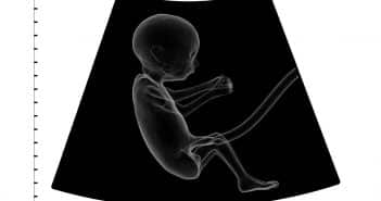 ultrasound, fetus, embryo