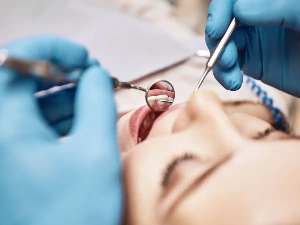 trous dans les dents