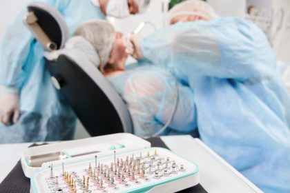 Les étapes essentielles de la pose d’un implant dentaire