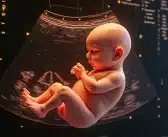 Écho 3D bébé trisomique : un regard inédit sur la trisomie 21