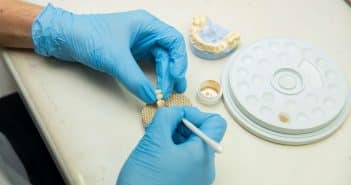 Quelles sont les différences entre une prothèse dentaire et un dentier ?
