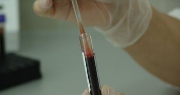 Pourquoi ne pas fumer avant un test sanguin ?